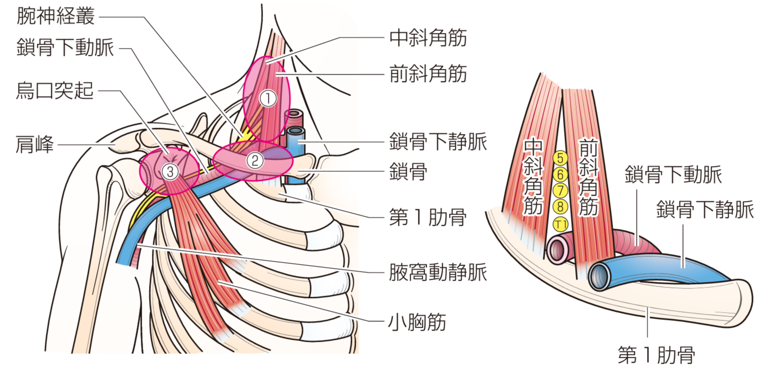 胸郭出口症候群の説明